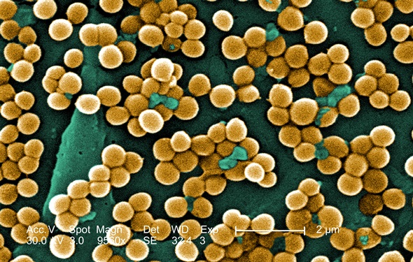 SUPERMIEL_Staphylococcus_aureus